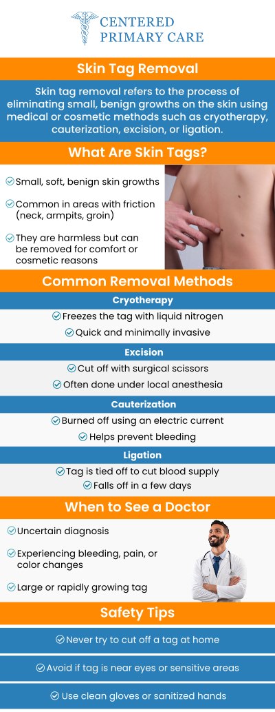 Skin tag removal is a simple and effective procedure to eliminate unwanted growths from your skin. Various methods can be used to safely remove skin tags with minimal discomfort. The procedure is quick and can be performed in a clinical setting, allowing you to return to your daily routine immediately. For those seeking professional care, Dr. Roberto Amado and the team at Centered Primary Care in Stoughton, MA, offer safe and efficient skin tag removal solutions. For more information, contact us today or schedule an appointment online. We are conveniently located at 966 Park Street, Suite B6, Stoughton, MA 02072. Skin tag removal is a simple and effective procedure to eliminate unwanted growths from your skin. Various methods can be used to safely remove skin tags with minimal discomfort. The procedure is quick and can be performed in a clinical setting, allowing you to return to your daily routine immediately. For those seeking professional care, Dr. Roberto Amado and the team at Centered Primary Care in Stoughton, MA, offer safe and efficient skin tag removal solutions. For more information, contact us today or schedule an appointment online. We are conveniently located at 966 Park Street, Suite B6, Stoughton, MA 02072.